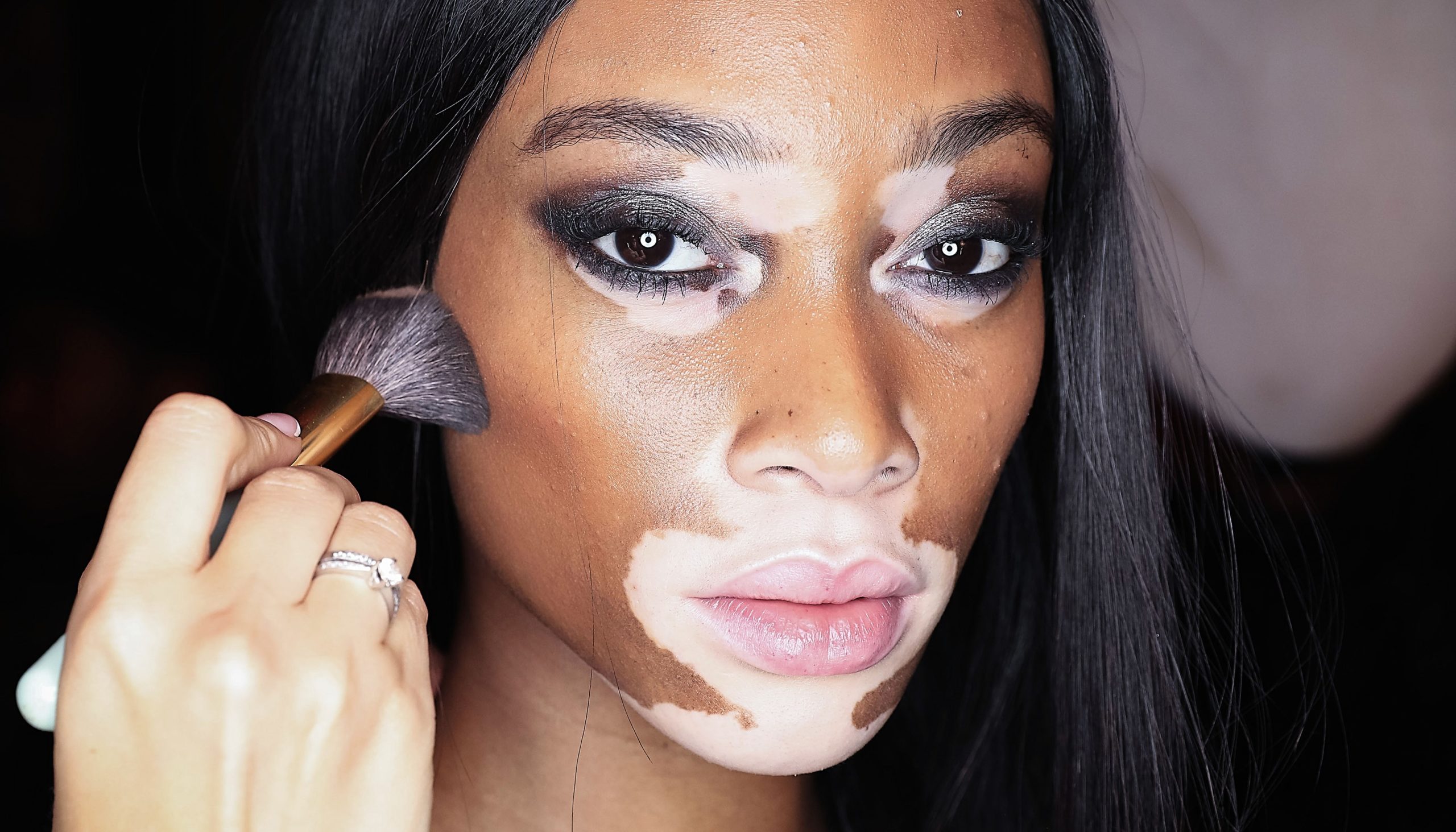 This Woman With Vitiligo Uses Eye Makeup to Shut Down Insults About Her Skin