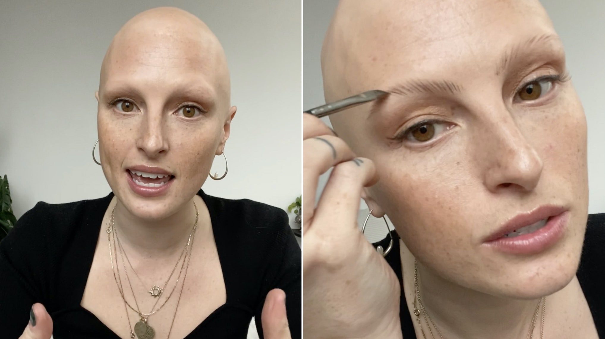 Why Model Amber Jean Rowan Created the Alopecia Community She Never Had