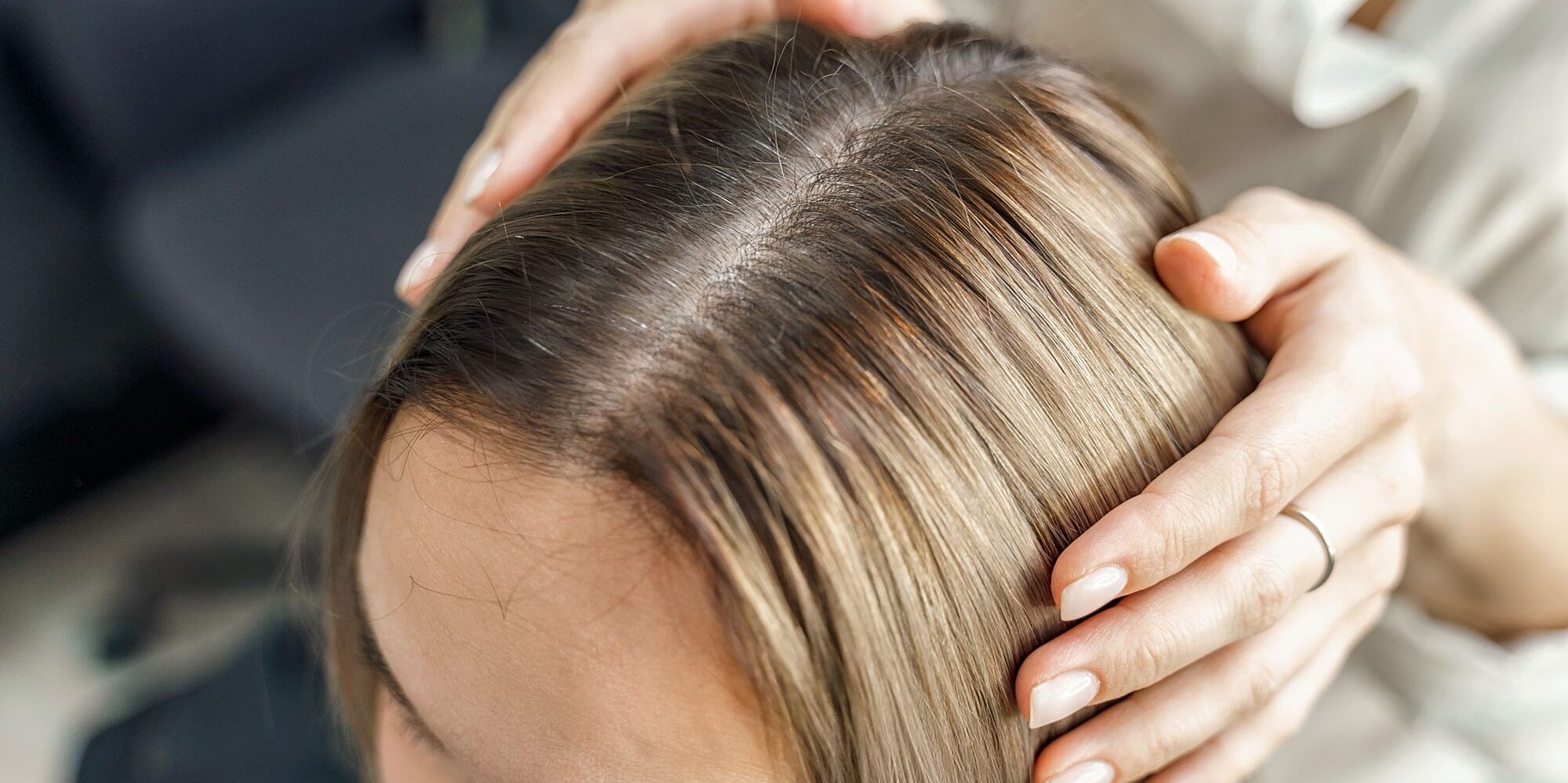 Is Your Hair's Part Line Getting Wider? Here's What May Be Happening—and What to Do About It